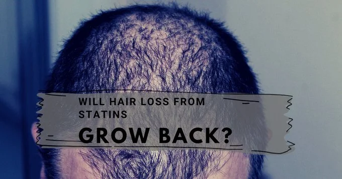 statins and hair loss